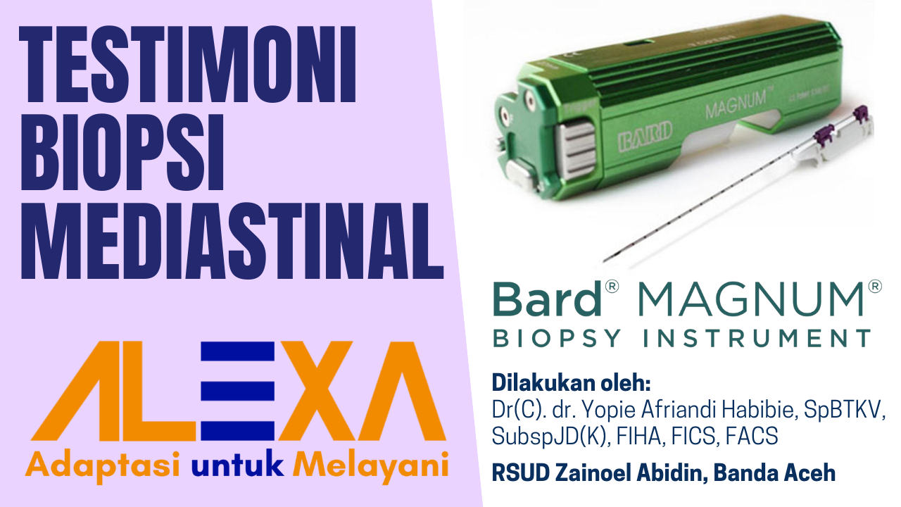 Testimonial Penggunaan Bard Magnum Biopsy Instrument oleh Dokter Spesialis Bedah Toraks Kardiovaskul